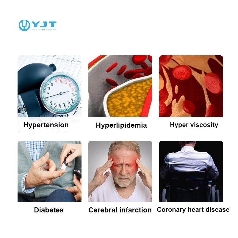 นาฬิกาอัจฉริยะ YJT OEM ODM รุ่ - Smart Watch บทวิจารณ์และราคา